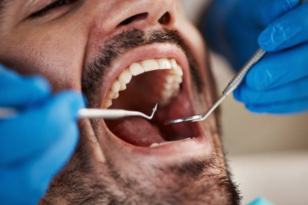 Best Emergency Tooth Extraction  in Dixmoor, IL